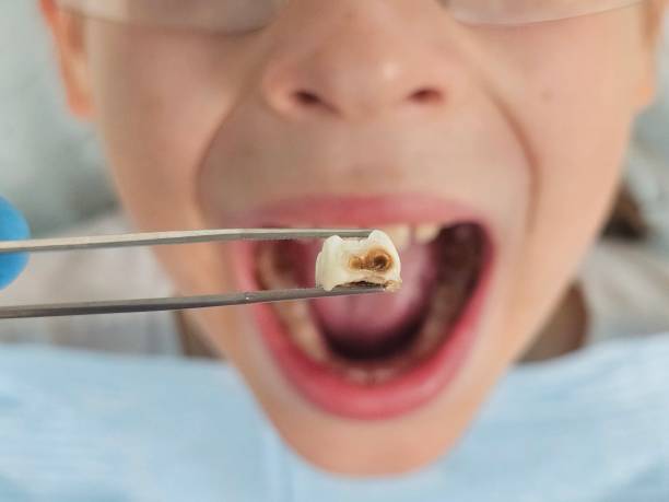 Best Orthodontic Emergency Dentist in Decatur, AL